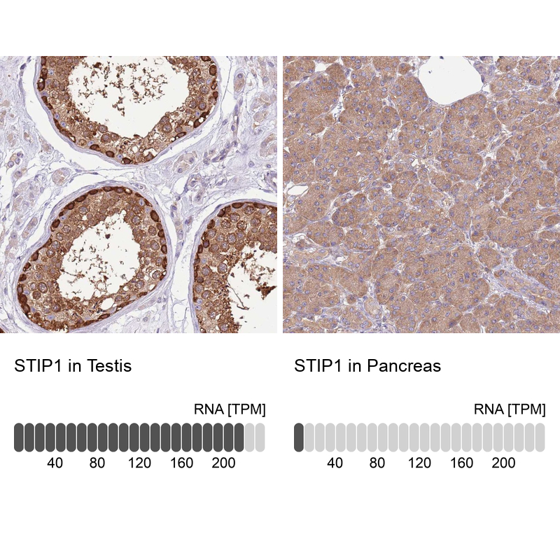 Immunohistochemistry analysis in human testis and pancreas tissues using Anti-STIP1 antibody. Corresponding STIP1 RNA-seq data are presented for the same tissues.