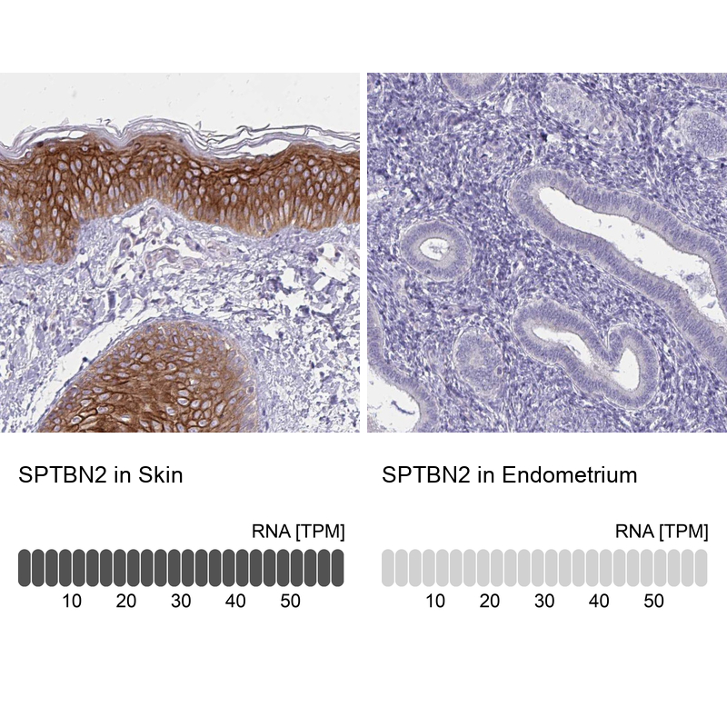Immunohistochemistry analysis in human skin and endometrium tissues using Anti-SPTBN2 antibody. Corresponding SPTBN2 RNA-seq data are presented for the same tissues.