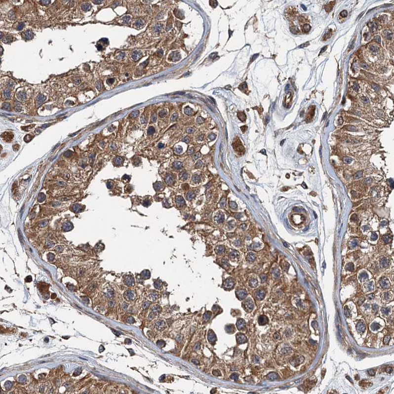 Immunohistochemical staining of human testis shows moderate cytoplasmic positivity in cells in seminiferous ducts.