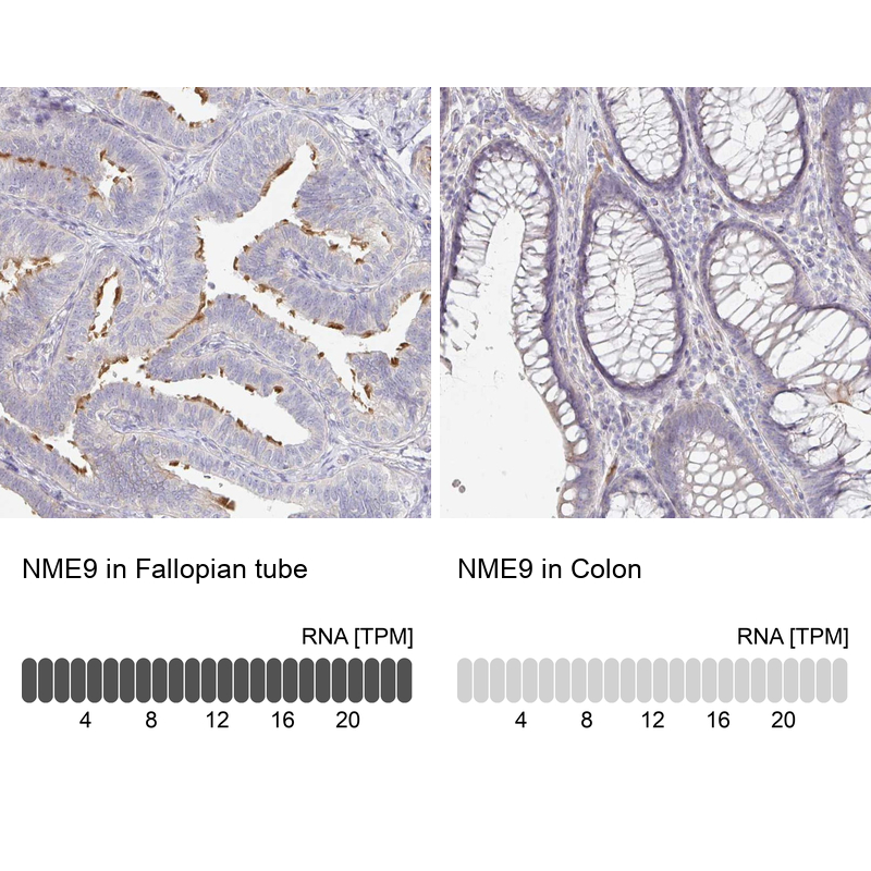 Immunohistochemistry analysis in human fallopian tube and colon tissues using Anti-NME9 antibody. Corresponding NME9 RNA-seq data are presented for the same tissues.