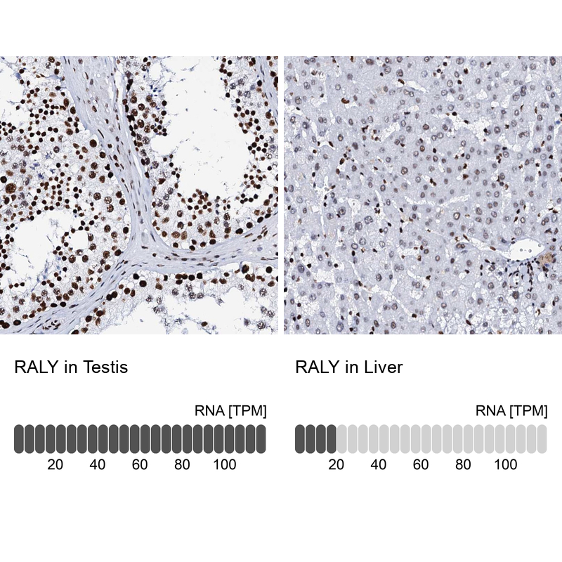 Immunohistochemistry analysis in human testis and liver tissues using Anti-RALY antibody. Corresponding RALY RNA-seq data are presented for the same tissues.