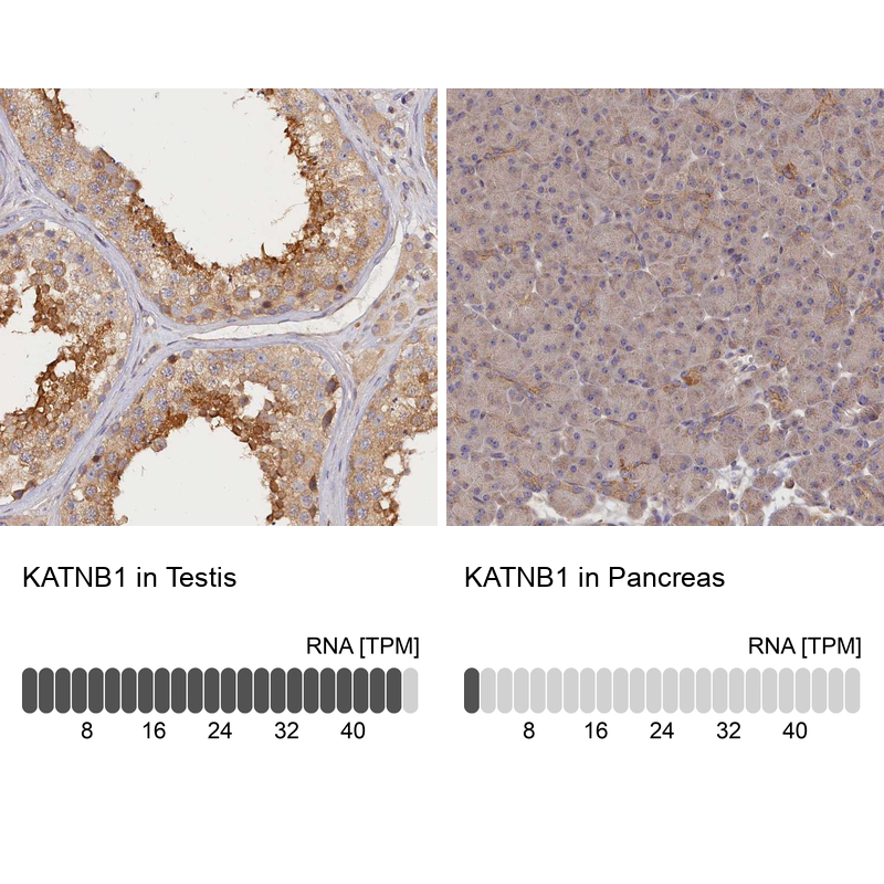 Immunohistochemistry analysis in human testis and pancreas tissues using Anti-KATNB1 antibody. Corresponding KATNB1 RNA-seq data are presented for the same tissues.