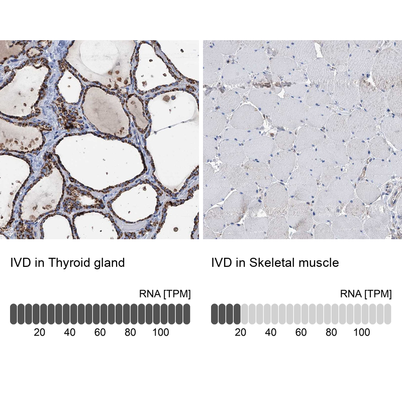 Immunohistochemistry analysis in human thyroid gland and skeletal muscle tissues using Anti-IVD antibody. Corresponding IVD RNA-seq data are presented for the same tissues.