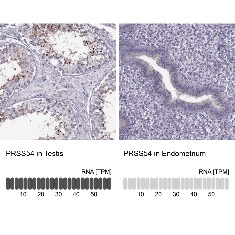 Immunohistochemistry analysis in human testis and endometrium tissues using Anti-PRSS54 antibody. Corresponding PRSS54 RNA-seq data are presented for the same tissues.
