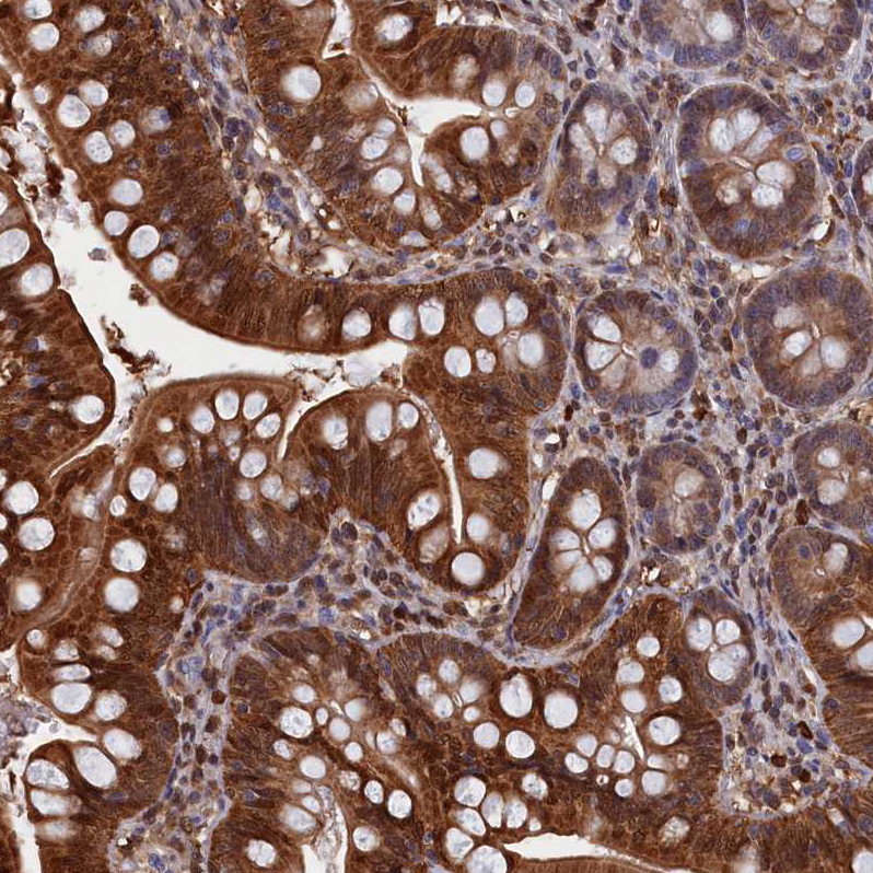 Immunohistochemical staining of human small intestine shows strong cytoplasmic positivity in glandular cells.
