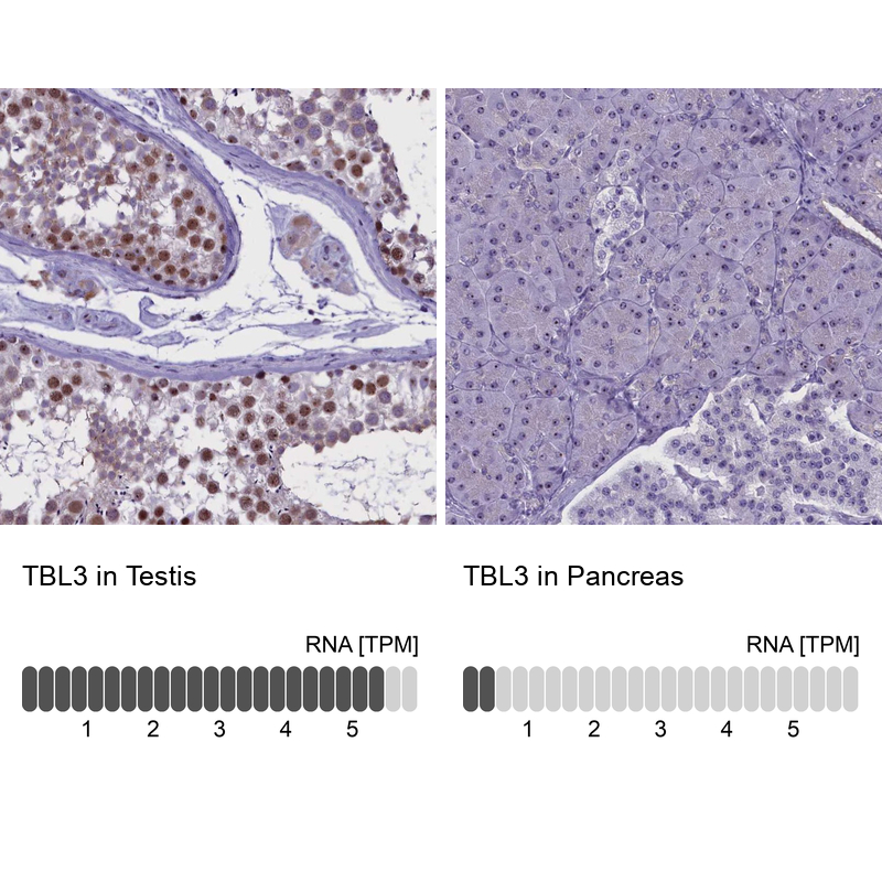 Immunohistochemistry analysis in human testis and pancreas tissues using Anti-TBL3 antibody. Corresponding TBL3 RNA-seq data are presented for the same tissues.