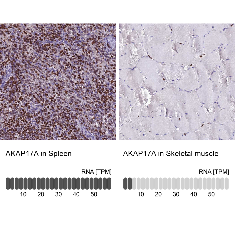 Immunohistochemistry analysis in human spleen and skeletal muscle tissues using Anti-AKAP17A antibody. Corresponding AKAP17A RNA-seq data are presented for the same tissues.