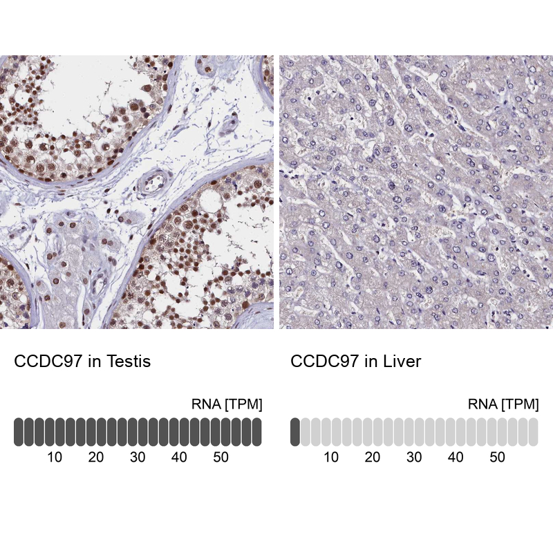 Immunohistochemistry analysis in human testis and liver tissues using Anti-CCDC97 antibody. Corresponding CCDC97 RNA-seq data are presented for the same tissues.