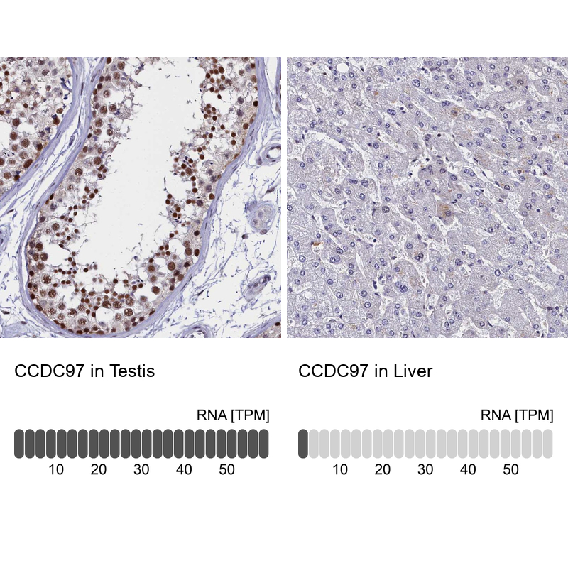 Immunohistochemistry analysis in human testis and liver tissues using Anti-CCDC97 antibody. Corresponding CCDC97 RNA-seq data are presented for the same tissues.