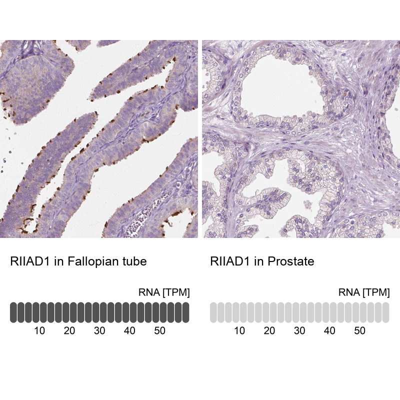 Immunohistochemistry analysis in human fallopian tube and prostate tissues using Anti-RIIAD1 antibody. Corresponding RIIAD1 RNA-seq data are presented for the same tissues.