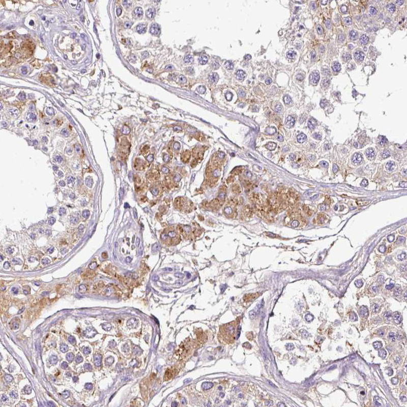 Immunohistochemical staining of human testis shows moderate cytoplasmic positivity in Leydig cells.