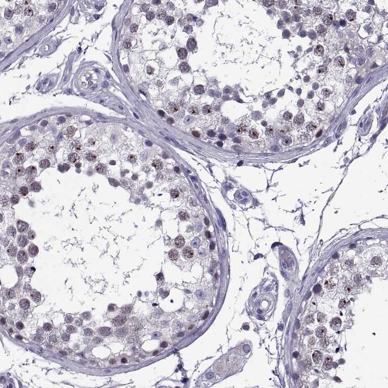 Immunohistochemical staining of human testis shows strong nuclear positivity in cells in seminiferous ducts.