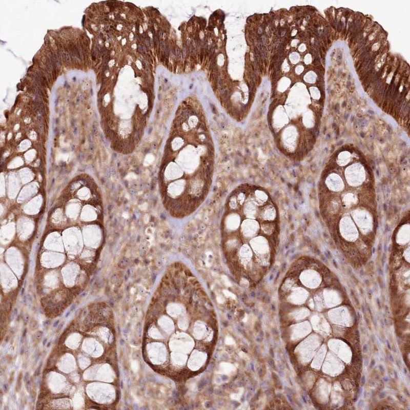 Immunohistochemical staining of human colon shows strong cytoplasmic positivity in glandular cells.
