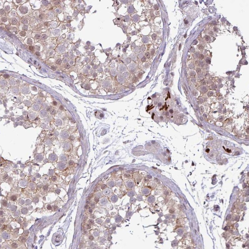 Immunohistochemical staining of human testis shows strong nuclear positivity in Leydig cells.
