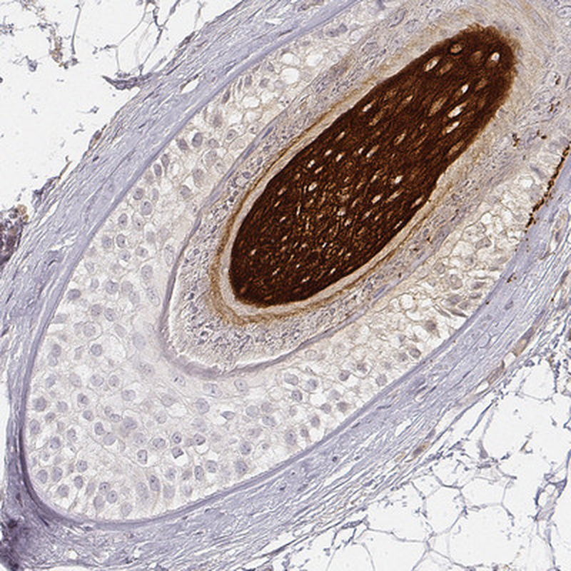 Immunohistochemical staining of human hair shows strong cytoplasmic positivity in cells in cortex/medulla.