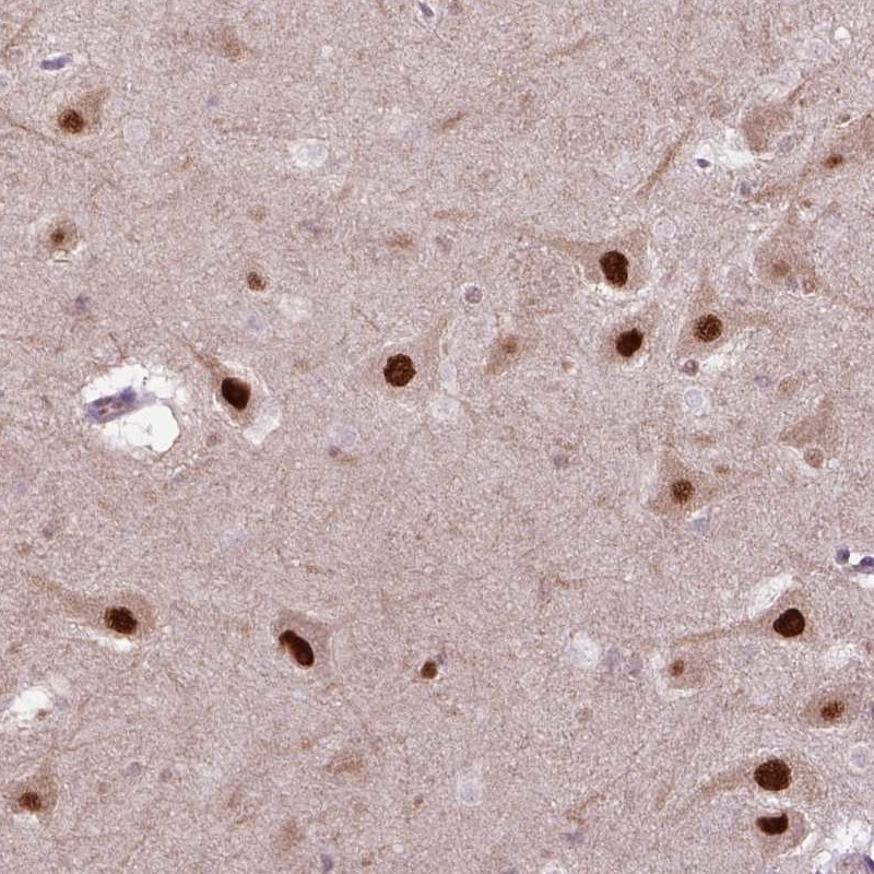 Immunohistochemical staining of human hippocampus shows strong nuclear positivity in neuronal cells.