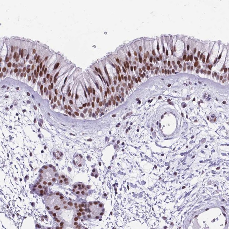Immunohistochemical staining of human nasopharynx shows strong nuclear positivity in respiratory epithelial cells.