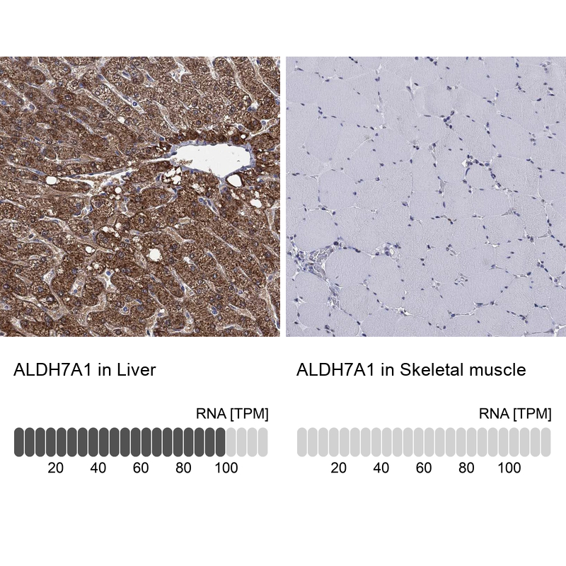 Immunohistochemistry analysis in human liver and skeletal muscle tissues using Anti-ALDH7A1 antibody. Corresponding ALDH7A1 RNA-seq data are presented for the same tissues.