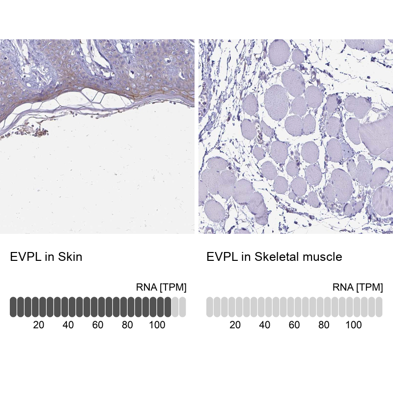Immunohistochemistry analysis in human skin and skeletal muscle tissues using Anti-EVPL antibody. Corresponding EVPL RNA-seq data are presented for the same tissues.