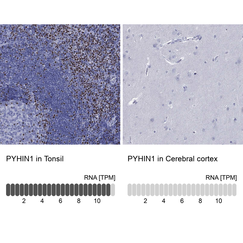 Immunohistochemistry analysis in human tonsil and cerebral cortex tissues using Anti-PYHIN1 antibody. Corresponding PYHIN1 RNA-seq data are presented for the same tissues.