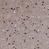 Immunohistochemical staining of human cerebral cortex shows strong nuclear positivity in neuronal cells.