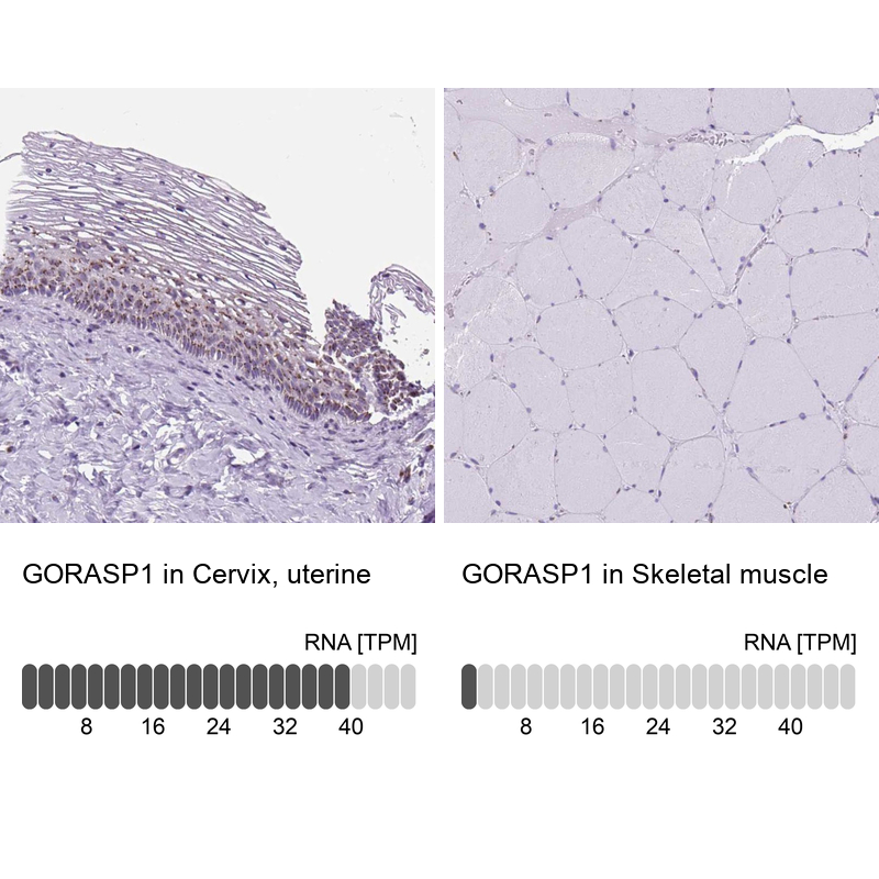 Immunohistochemistry analysis in human cervix, uterine and skeletal muscle tissues using Anti-GORASP1 antibody. Corresponding GORASP1 RNA-seq data are presented for the same tissues.