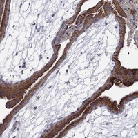 Immunohistochemical staining of human placenta shows strong cytoplasmic positivity in trophoblastic cells.