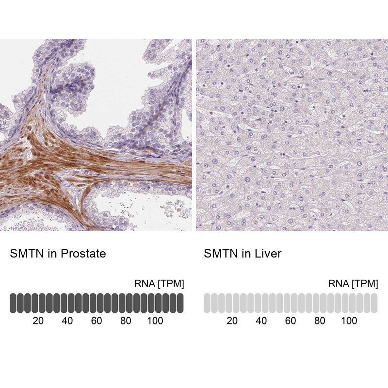 Immunohistochemical staining of human rectum shows moderate to strong cytoplasmic positivity in smooth muscle cells.