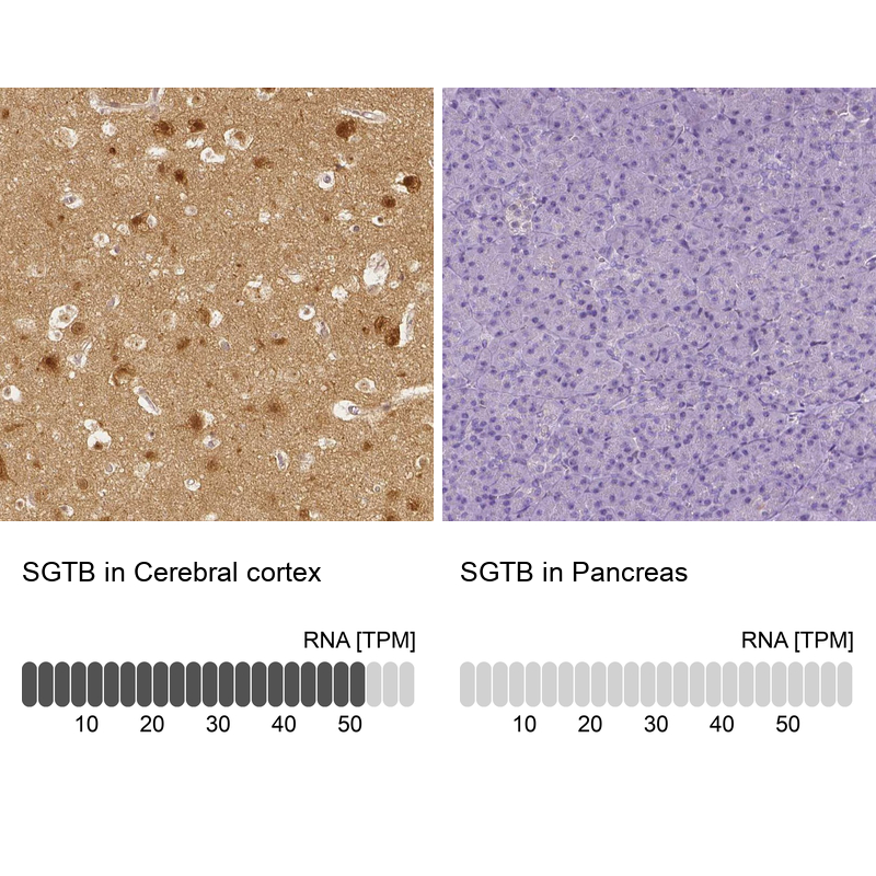 Immunohistochemistry analysis in human cerebral cortex and pancreas tissues using Anti-SGTB antibody. Corresponding SGTB RNA-seq data are presented for the same tissues.