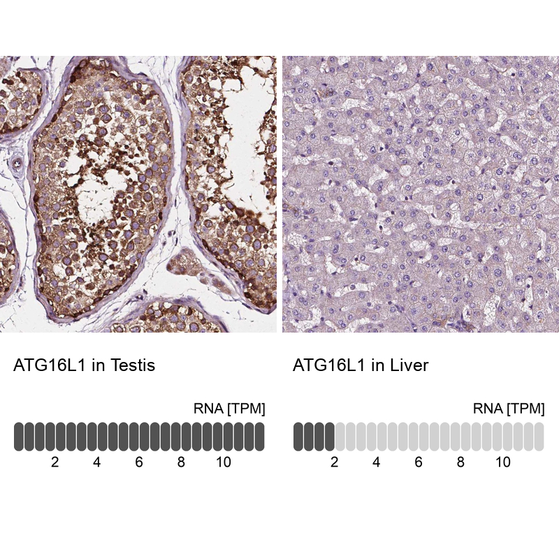 Immunohistochemistry analysis in human testis and liver tissues using Anti-ATG16L1 antibody. Corresponding ATG16L1 RNA-seq data are presented for the same tissues.