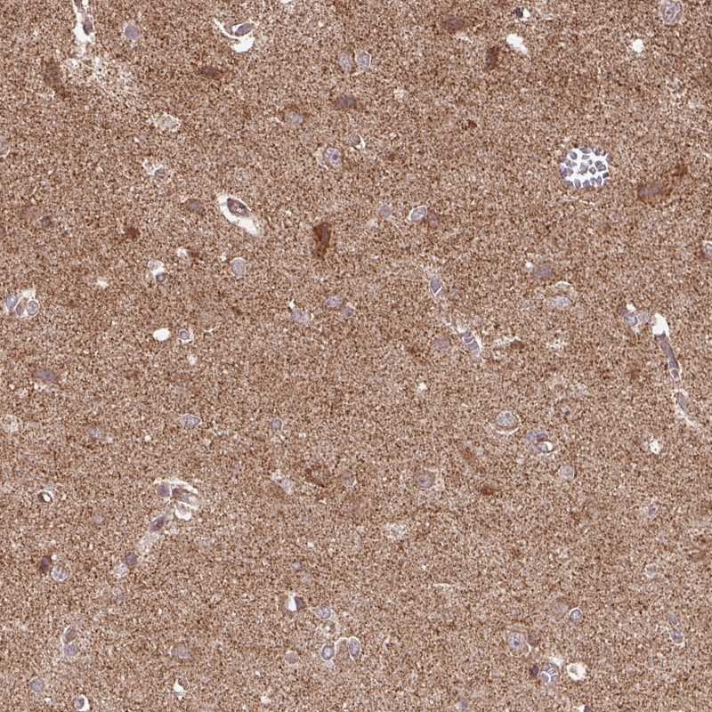 Immunohistochemical staining of human cerebral cortex shows cytoplasmic positivity in neuronal and glial cells.