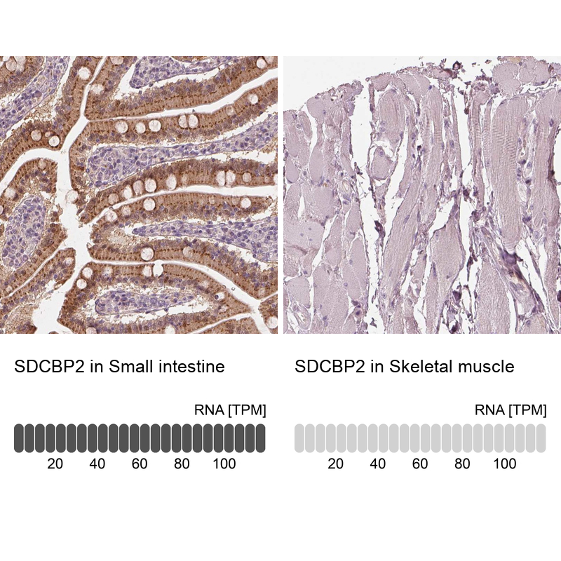 Immunohistochemistry analysis in human small intestine and skeletal muscle tissues using Anti-SDCBP2 antibody. Corresponding SDCBP2 RNA-seq data are presented for the same tissues.