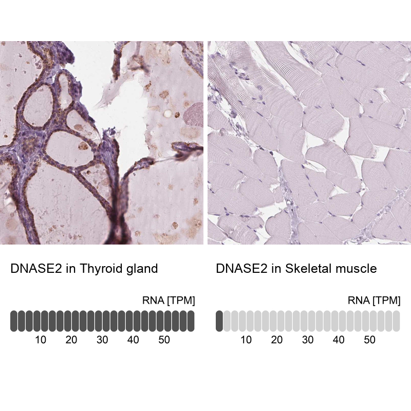 Immunohistochemistry analysis in human thyroid gland and skeletal muscle tissues using Anti-DNASE2 antibody. Corresponding DNASE2 RNA-seq data are presented for the same tissues.