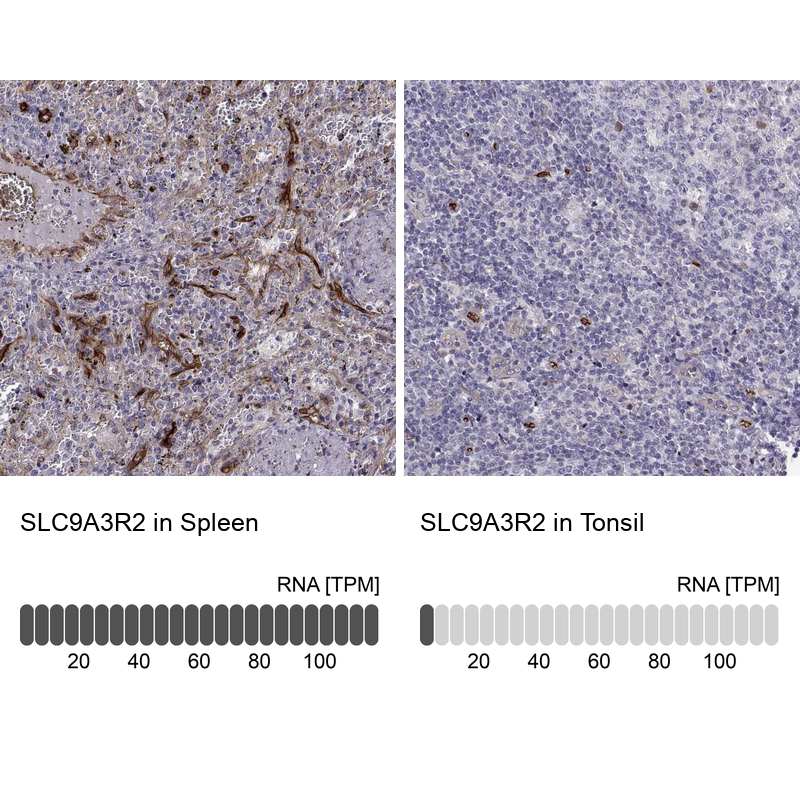 Immunohistochemistry analysis in human spleen and tonsil tissues using Anti-SLC9A3R2 antibody. Corresponding SLC9A3R2 RNA-seq data are presented for the same tissues.