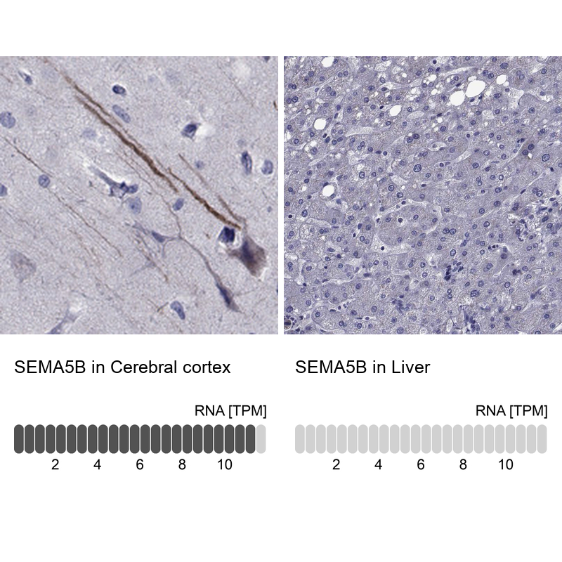 Immunohistochemistry analysis in human cerebral cortex and liver tissues using Anti-SEMA5B antibody. Corresponding SEMA5B RNA-seq data are presented for the same tissues.