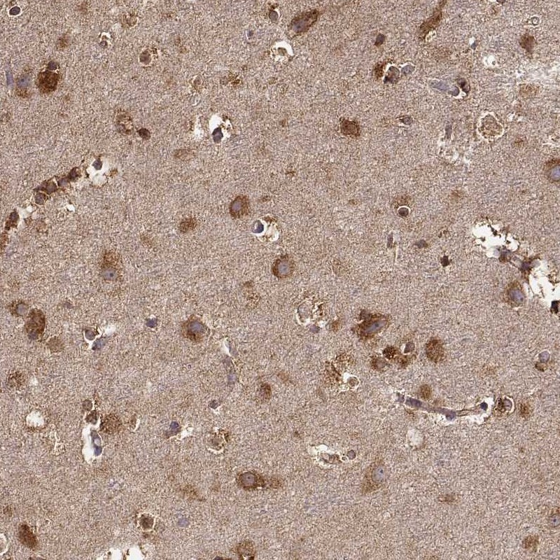 Immunohistochemical staining of human cerebral cortex shows strong granular cytoplasmic positivity in neuronal and glial cells.