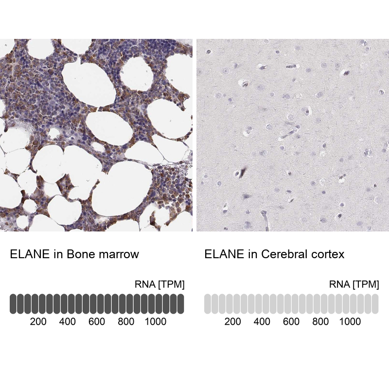 Immunohistochemistry analysis in human bone marrow and cerebral cortex tissues using Anti-ELANE antibody. Corresponding ELANE RNA-seq data are presented for the same tissues.