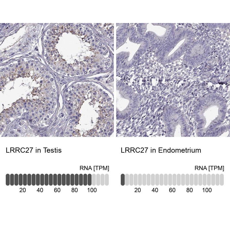 Immunohistochemistry analysis in human testis and endometrium tissues using Anti-LRRC27 antibody. Corresponding LRRC27 RNA-seq data are presented for the same tissues.
