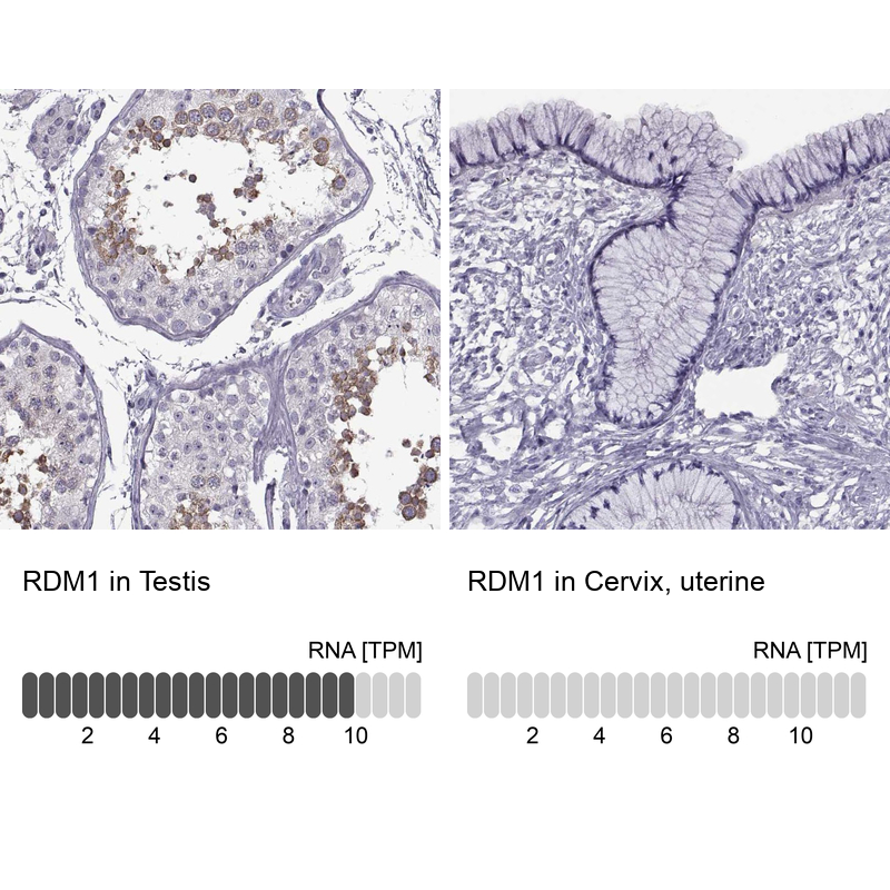 Immunohistochemistry analysis in human testis and cervix, uterine tissues using Anti-RDM1 antibody. Corresponding RDM1 RNA-seq data are presented for the same tissues.