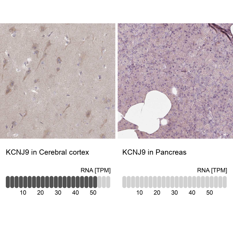 Immunohistochemistry analysis in human cerebral cortex and pancreas tissues using Anti-KCNJ9 antibody. Corresponding KCNJ9 RNA-seq data are presented for the same tissues.