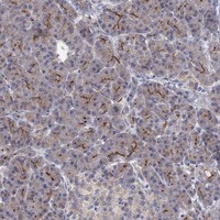 Immunohistochemical staining of human pancreas shows strong membranous positivity in exocrine glandular cells.