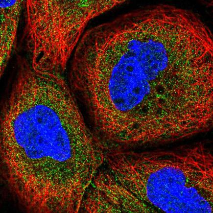 Anti-CPTP Antibody (HPA056832) - Atlas Antibodies
