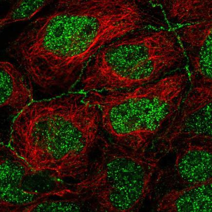 Anti-APOC3 Antibody (HPA065365) - Atlas Antibodies