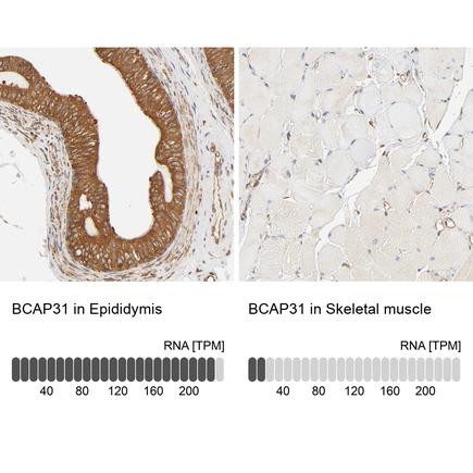 bcap31