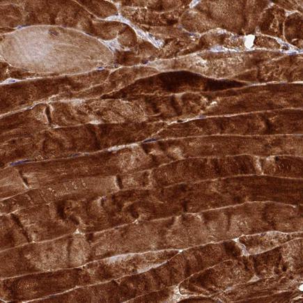Anti-MRRF Antibody (HPA047177) - Atlas Antibodies