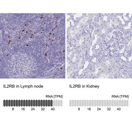 Rabbit Polyclonal AntiIL2RB Antibody Buy for research Atlas Antibodies