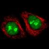 ICC of Anti-ADAR Antibody AMAb90535