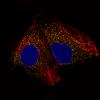 ICC of Anti-ACAA1 Antibody AMAb91020