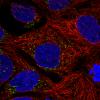 ICC of Anti-ACAA1 Antibody AMAb91022