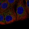 ICC of Anti-ACAA1 Antibody AMAb91024